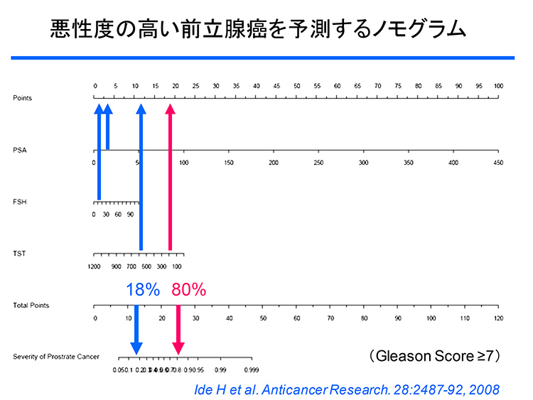 悪性度の高い前立腺癌を予測するモノグラム